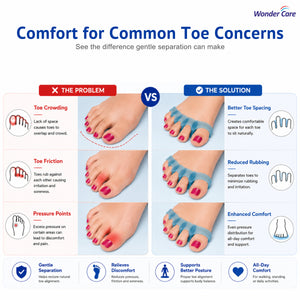 BUY 1 Get 1 FREE Wonder Care Silicone Toe Separator For Feet Gel Toe Pads Toe Big Toe Corrector Bunion Toe Straightener Yoga Toe Stretcher Hammer Toe Bunion