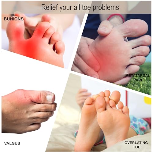 BUY 1 Get 1 FREE Wonder Care Silicone Toe Separator For Feet Gel Toe Pads Toe Big Toe Corrector Bunion Toe Straightener Yoga Toe Stretcher Hammer Toe Bunion