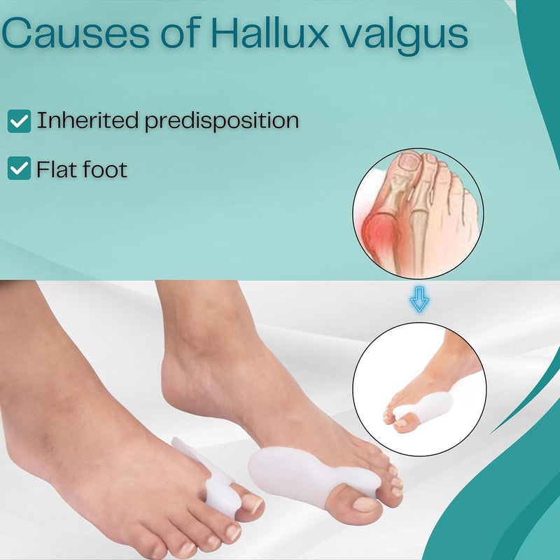 BUY 1 Get 1 FREE Wonder Care Silicone Toe Separator For Feet Gel Toe Pads Toe Big Toe Corrector Bunion Toe Straightener Yoga Toe Stretcher Hammer Toe Bunion White [Pair of 1-2 Pieces]